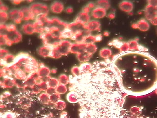 显微镜下的血细胞图片手绘