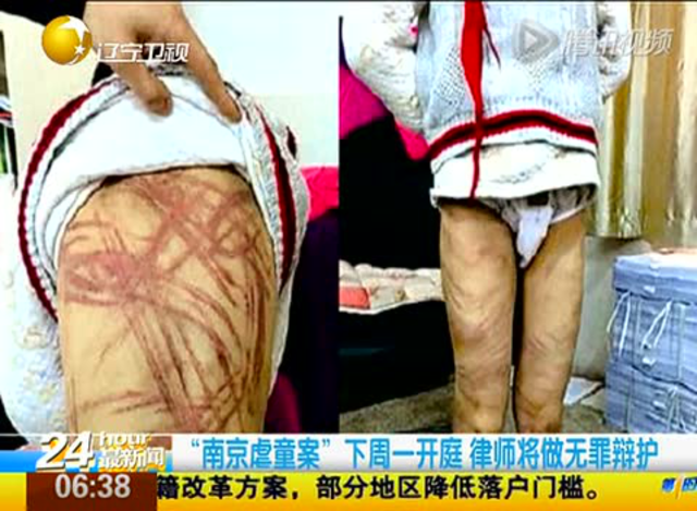南京虐童案28日开审 养母将提交男童轻微伤鉴定