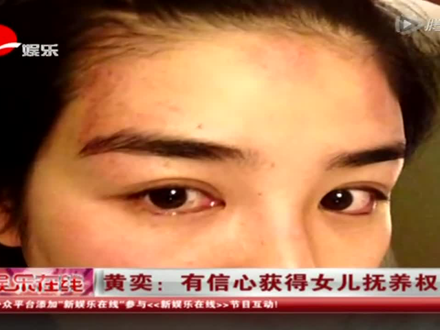 黄奕晒家暴受伤图 誓要争夺女儿抚养权截图