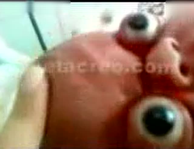 印度妇女生出怪胎,刚出生竟如70岁老人