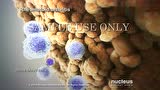 nucleus医学视频—类风湿关节炎中文字幕版