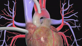 3D超清演示三种心脏搭桥手术，终于看明白了_腾讯视频
