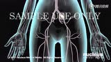 深静脉血栓和肺栓塞-3D医学动画_腾讯视频
