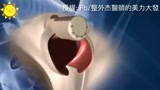 男女变性手术过程