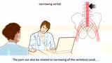 医学动画 坐骨神经痛如何治疗_腾讯视频