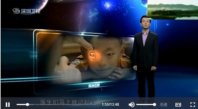 夜视奇人,神秘的猫眼男孩下