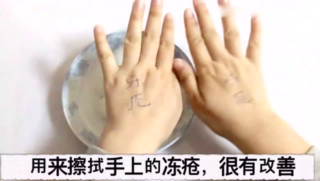 冬天手上容易长冻疮怎么办?擦这个帮你解决