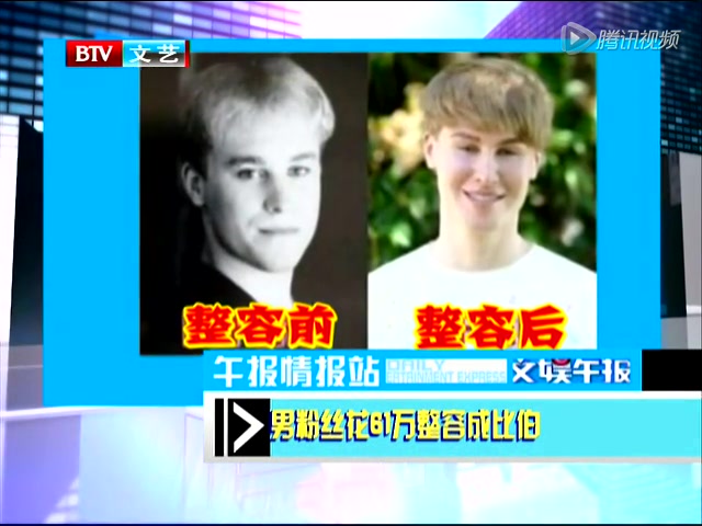 外媒：伊朗人嫌鼻子太大 全民掀起整容风潮
