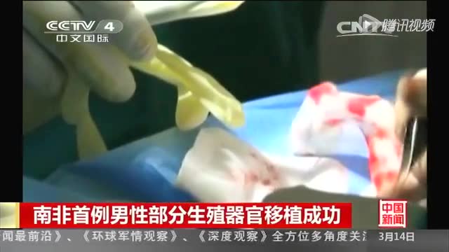南非首例男性部分生殖器官移植成功截图