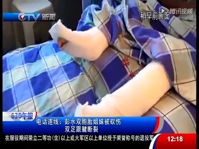 彭水双胞胎女孩被继爷爷砍断脚筋 现在主城医院治疗