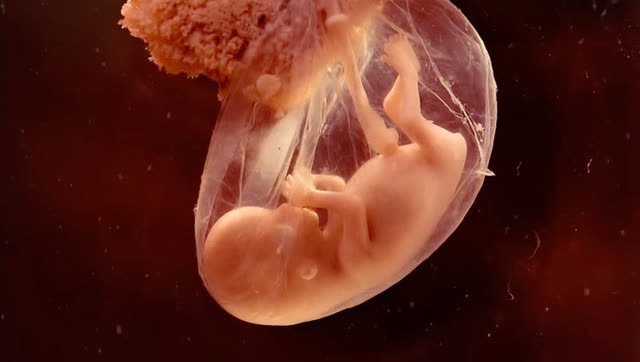怀孕23周宝宝如芒果般大了,你看一条条血管已经清晰可辨